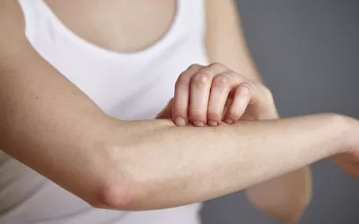 A woman scratching her forearm, showing signs of skin redness and irritation.