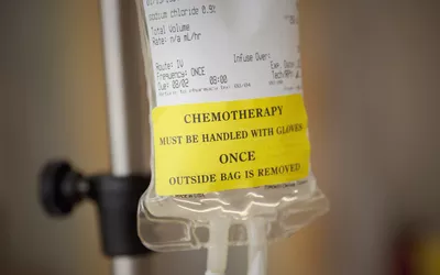 A chemotherapy IV bag with a yellow safety warning label on a hospital stand.